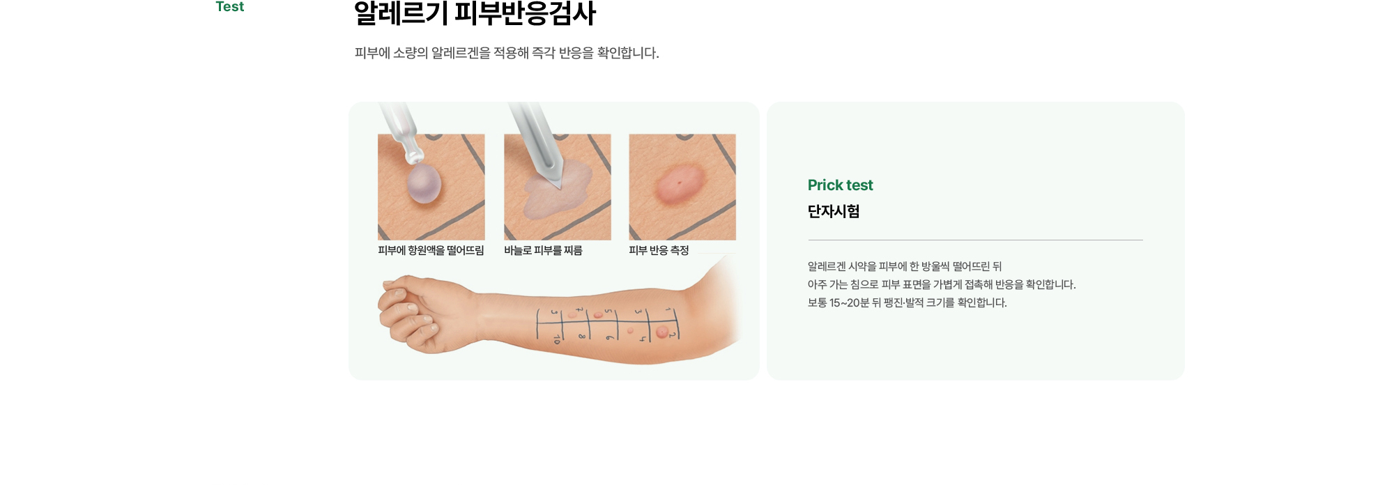 알레르기 피부반응검사 | 피부에 소량의 알레르겐을 적용해 즉각 반응을 확인합니다.