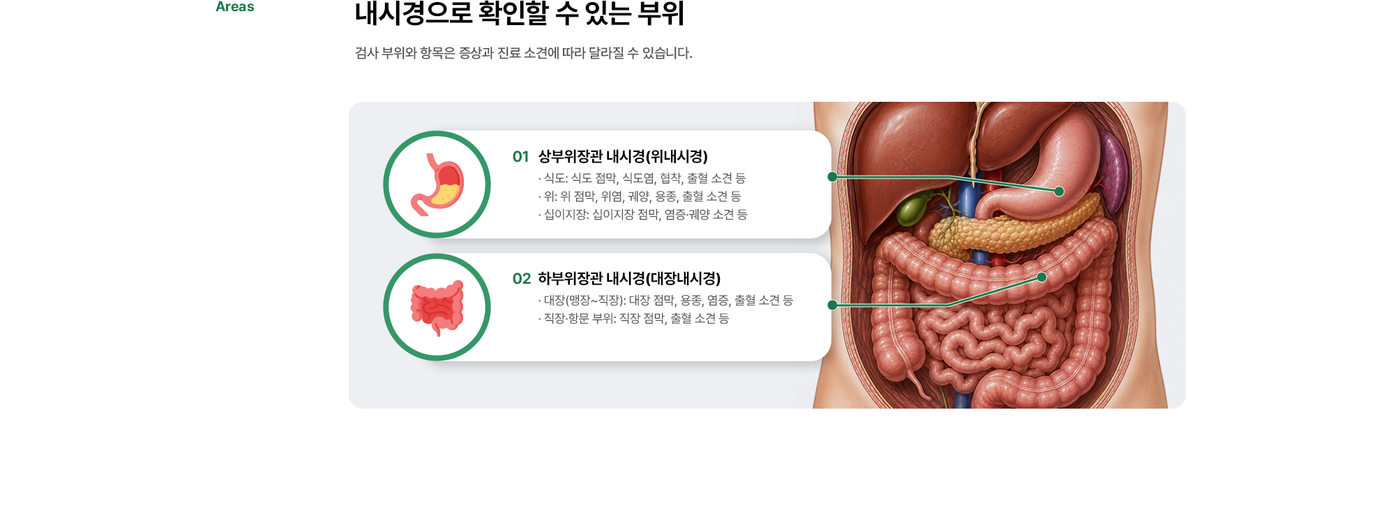 내시경으로 확인할 수 있는 부위 | 상부위장관 내시경(위내시경), 하부위장관 내시경(대장내시경)