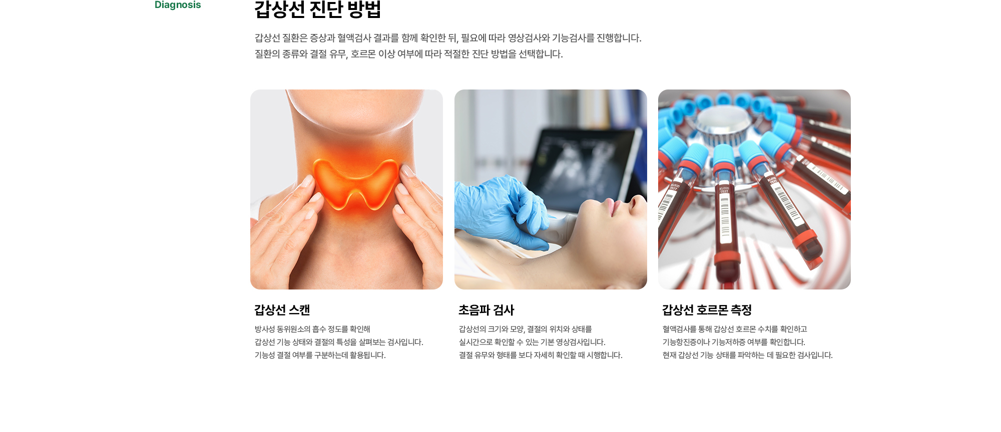 갑상선 진단 방법 | 갑상선 질환은 증상과 혈액검사 결과를 함께 확인한 뒤, 필요에 따라 영상검사와 기능검사를 진행합니다. 질환의 종류와 결절 유무, 호르몬 이상 여부에 따라 적절한 진단 방법을 선택합니다. 갑상선 스캔, 초음파 검사, 갑상선 호르몬 측정